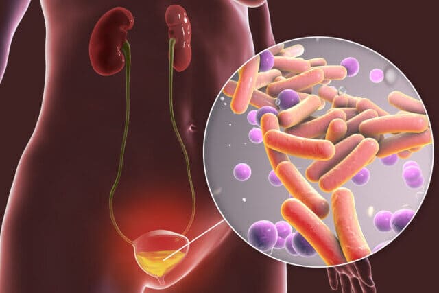 Flora bacteriana na urina